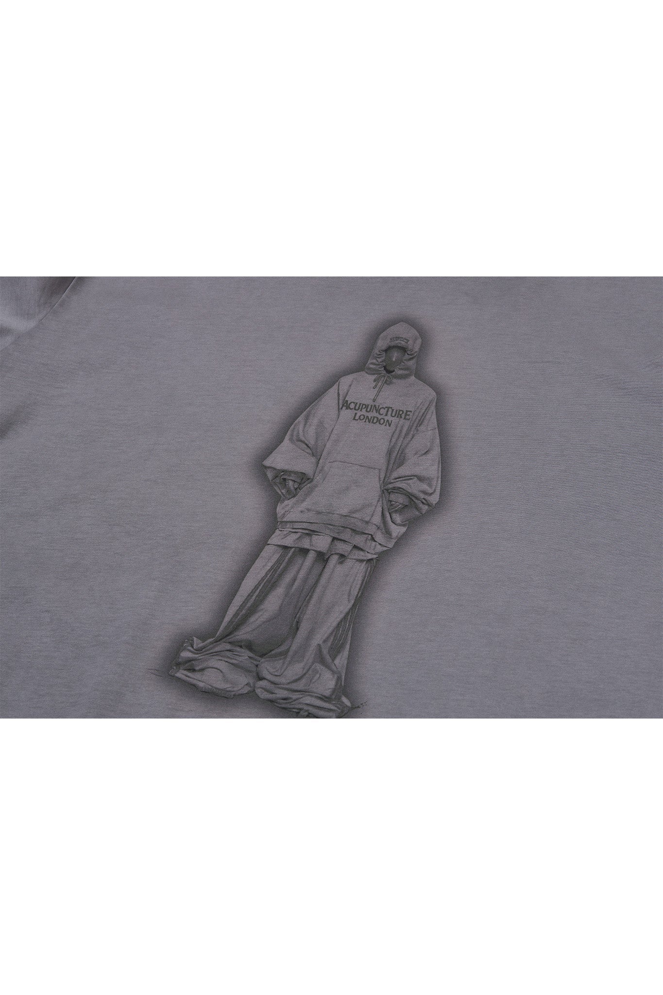 Acupuncture Over Sant T-Shirt